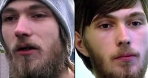Άντρας δείχνει τα δόντια του που έχει να τα πλύνει 20 χρόνια