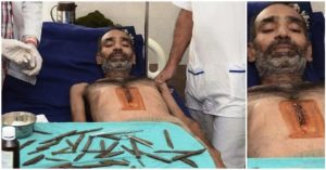 Έβαλαν “Φακίρη” στο Χειρουργικό Τραπέζι για να τον αφαιρέσουν 40 μαχαίρια
