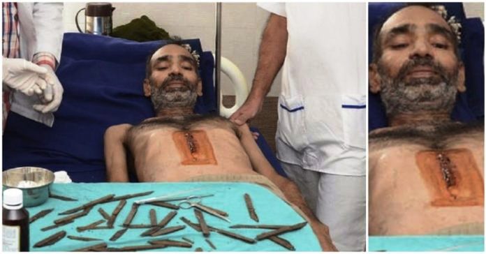 Έβαλαν “Φακίρη” στο Χειρουργικό Τραπέζι για να τον αφαιρέσουν 40 μαχαίρια
