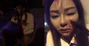 Έφηβη είχε ένα μαχαίρι καρφωμένο στο πρόσωπό της μετά από ληστεία