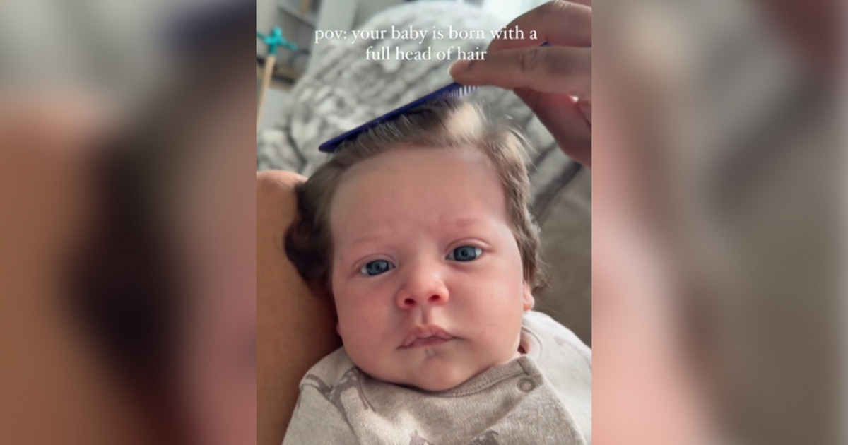 Νεογέννητο έγινε viral, γιατί έχει πυκνό μαλλί και μοιάζει με μεσήλικα